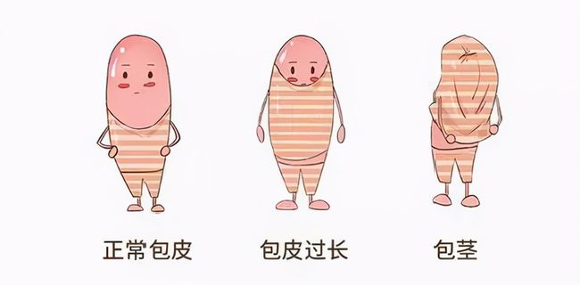 儿童包皮一定要切吗,齐齐哈尔附大男科乐动体育·（中国）体育官方网站